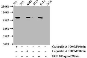 Western Blot  Positive WB detected in: 293 whole cell lysate, A549 whole cell lysate, Hela whole cell lysate (treated with Calyculin A or EGF)  All lanes: Phospho-ERN1 antibody at 0. (Recombinant ERN1 antibody  (pSer724))