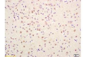 Formalin-fixed and paraffin embedded rat brain labeled with Rabbit Anti PRKAG2/AMPK? (AMPK gamma 1/2/3 (AA 280-330) antibody)