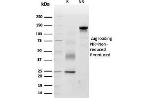 SDS-PAGE Analysis Purified Periostin (POSTN) Mouse Monoclonal Antibody (POSTN/3503). (Periostin antibody  (AA 193-326))