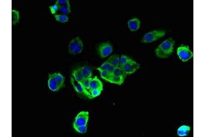 Immunofluorescent analysis of MCF-7 cells using ABIN7173183 at dilution of 1:100 and Alexa Fluor 488-congugated AffiniPure Goat Anti-Rabbit IgG(H+L) (TMEM256 antibody  (AA 30-63))