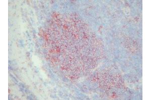 Immunohistochemistry (IHC) image for anti-Transferrin Receptor (p90, CD71) (TFRC) antibody (ABIN781719) (Transferrin Receptor antibody)