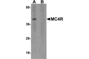 Western Blotting (WB) image for anti-Melanocortin 4 Receptor (MC4R) (N-Term) antibody (ABIN1031454) (MC4R antibody  (N-Term))