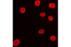 Immunofluorescent analysis of Histone Deacetylase 9 staining in Ramos cells. (HDAC9 antibody  (C-Term))