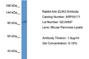 Western Blotting (WB) image for anti-Zinc Finger CCCH-Type Containing 3 (ZC3H3) (N-Term) antibody (ABIN785735) (ZC3H3 antibody  (N-Term))