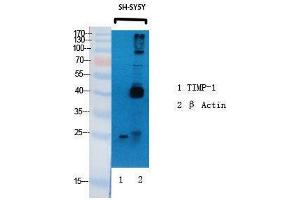 Western Blotting (WB) image for anti-TIMP Metallopeptidase Inhibitor 1 (TIMP1) (Internal Region) antibody (ABIN3177726) (TIMP1 antibody  (Internal Region))