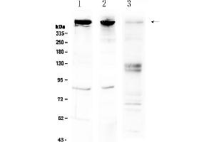 Western blot analysis of Sacsin using anti-Sacsin antibody . (Sacsin antibody  (AA 3709-3909))