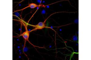 Immunofluorescence labeling of PFA fixed rat hippocampus neurons with β3-tubulin (dilution 1 : 500; red) and mouse anti-MAP 2 (cat. (TUBB3 antibody)