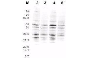This product was assayed by western blotting against RFA2 containing cell lysates. (RPA2 antibody  (AA 115-129))
