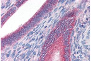 Human Uterus (formalin-fixed, paraffin-embedded) stained with DRAM antibody ABIN351448 at 3 ug/ml followed by biotinylated goat anti-rabbit IgG secondary antibody ABIN481713, alkaline phosphatase-streptavidin and chromogen. (DRAM antibody  (C-Term))