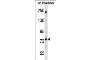 Western blot analysis in mouse bladder tissue lysates (35ug/lane). (GCLC antibody  (AA 286-315))