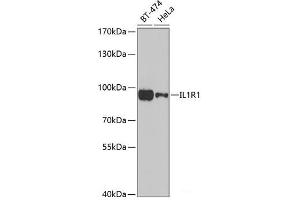 Western blot analysis of extracts of various cell lines using IL1R1 Polyclonal Antibody at dilution of 1:1000. (IL1R1 antibody)