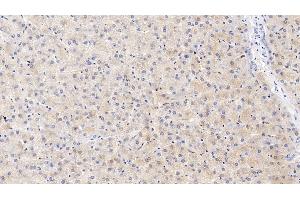 Detection of ITIH4 in Human Liver Tissue using Polyclonal Antibody to Inter Alpha-Globulin Inhibitor H4 (ITIH4) (ITIH4 antibody  (AA 683-928))