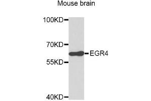 Western blot analysis of extracts of mouse brain, using EGR4 antibody (ABIN3049538). (EGR4 antibody)