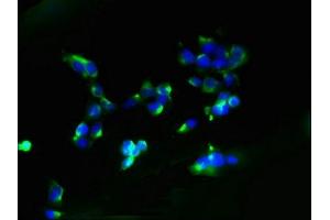 Immunofluorescent analysis of 293 cells using ABIN7173984 at dilution of 1:100 and Alexa Fluor 488-congugated AffiniPure Goat Anti-Rabbit IgG(H+L) (AGTRAP antibody  (AA 108-152))