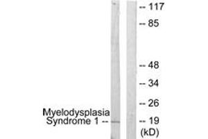 Image no. 1 for anti-MDS1 and EVI1 Complex Locus (MECOM) (AA 1-50) antibody (ABIN2889578) (MECOM antibody  (AA 1-50))