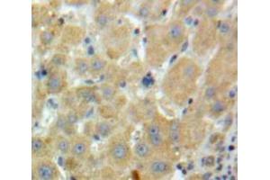 Used in DAB staining on fromalin fixed paraffin-embedded Liver tissue (Factor XI antibody  (AA 170-398))