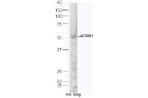 Mouse lung lysates probed with Rabbit Anti-ADRB1 Polyclonal Antibody, Unconjugated  at 1:5000 for 90 min at 37˚C. (ADRB1 antibody  (AA 181-250))