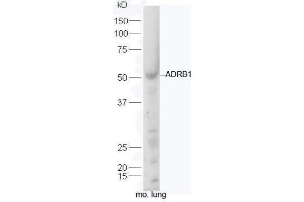 ADRB1 Antikörper  (AA 181-250)