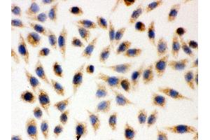 Anti- AIF Picoband antibody, ICC ICC: SMMC-7721 Cell