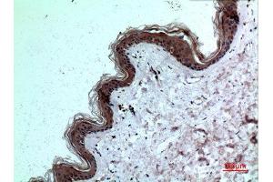 Immunohistochemistry (IHC) analysis of paraffin-embedded Human Skin, antibody was diluted at 1:100. (IL-8 antibody  (C-Term))