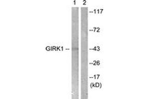 Western blot analysis of extracts from NIH-3T3 cells, using GIRK1/KIR3. (KCNJ3 antibody  (AA 151-200))