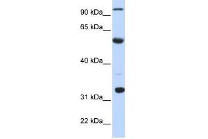 ApoBEC1 antibody used at 1 ug/ml to detect target protein. (APOBEC1 antibody  (N-Term))