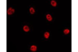 ABIN6275725 staining HepG2 by IF/ICC. (Tbpl2 antibody  (Internal Region))