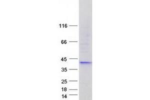 Validation with Western Blot (FBLIM1 Protein (Transcript Variant 3) (Myc-DYKDDDDK Tag))