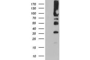 HEK293T cells were transfected with the pCMV6-ENTRY control (Left lane) or pCMV6-ENTRY PFKP (Right lane) cDNA for 48 hrs and lysed. (PFKP antibody)