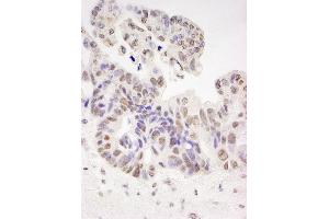 anti-HIV-1 Tat Specific Factor 1 (HTATSF1) (AA 375-425) antibody