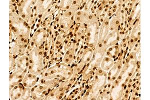 Phospho-MDC1 (Thr4) Antibody at 1/100 staining Rat liver tissue by IHC-P.