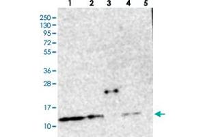 Western blot analysis of Lane 1: RT-4, Lane 2: U-251 MG, Lane 3: Human Plasma, Lane 4: Liver, Lane 5: Tonsil with CHCHD5 polyclonal antibody  at 1:250-1:500 dilution. (CHCHD5 antibody)