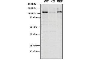 Western Blot analysis of Human, Mouse A549, MEF showing detection of VPS35 protein using Mouse Anti-VPS35 Monoclonal Antibody, Clone 8A3 (ABIN6932957). (VPS35 antibody  (Atto 390))