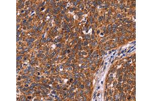 Immunohistochemistry (IHC) image for anti-Coiled-Coil Domain Containing 106 (CCDC106) antibody (ABIN2423069) (CCDC106 antibody)