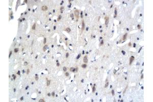 Formalin-fixed and paraffin embedded rat brain tissue labeled with Anti-PKC epsilon Polyclonal Antibody, Unconjugated (ABIN679538) followed by conjugation to the secondary antibody