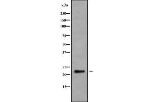 Western blot analysis NRSN2 using K562 whole cell lysates (NRSN2 antibody  (C-Term))