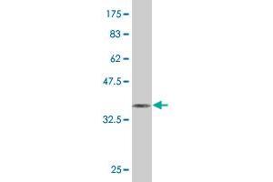 Western Blot detection against Immunogen (36. (HSF4 antibody  (AA 121-220))