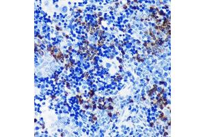 Immunohistochemistry of paraffin-embedded rat spleen using S100 Rabbit mAb (ABIN7270128) at dilution of 1:100 (40x lens). (S100A8 antibody)