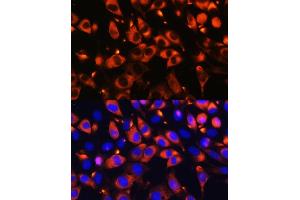 Immunofluorescence analysis of L929 cells using B9D1 Rabbit pAb (ABIN6133363, ABIN6137409, ABIN6137410 and ABIN6223982) at dilution of 1:100. (B9D1 antibody  (AA 1-130))