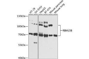 Western blot analysis of extracts of various cell lines, using RBM15B Antibody (ABIN6133322, ABIN6146763, ABIN6146764 and ABIN6225211) at 1:1000 dilution. (RBM15B antibody  (AA 540-720))