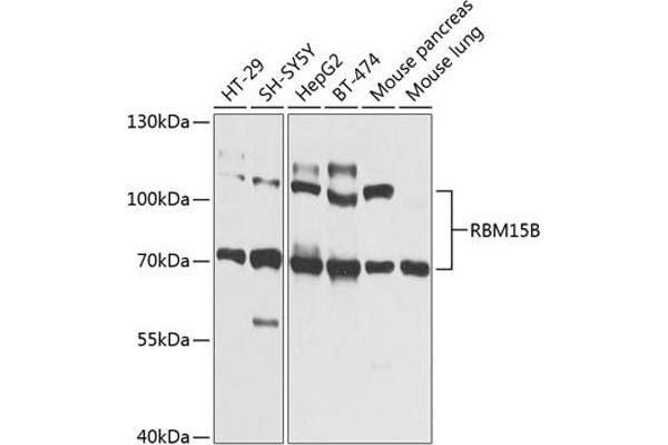RBM15B antibody  (AA 540-720)