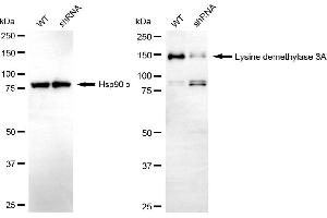 Western blotting analysis using lysine demethylase 3A antibody (ABIN7799300). (KDM3A antibody)