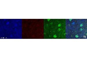 Immunohistochemistry (IHC) image for anti-Aldehyde Dehydrogenase 1 Family, Member A1 (ALDH1A1) antibody (ABIN7456135) (ALDH1A1 antibody)