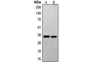 Western blot analysis of FAIM2 expression in U251 (A), EL4 (B) whole cell lysates.