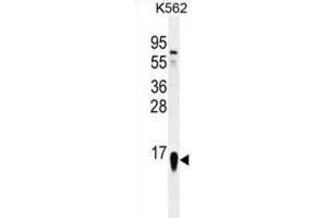 Western Blotting (WB) image for anti-Ribosomal Protein S19 (RPS19) antibody (ABIN2996506) (RPS19 antibody)