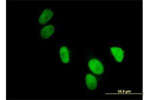 Immunofluorescence of purified MaxPab antibody to UBA2 on HeLa cell. (UBA2 antibody  (AA 1-640))