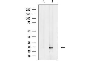 anti-Family with Sequence Similarity 96, Member B (FAM96B) (Internal Region) antibody