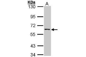WB Image Sample (30 ug of whole cell lysate) A: Hep G2 , 7. (IMPDH2 antibody)