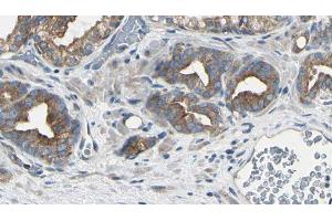 ABIN6279781 at 1/100 staining Human prostate tissue by IHC-P. (RPL22/L1 antibody)