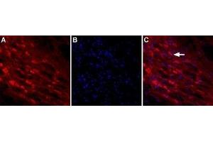 Expression of NLGN2 in rat brainImmunnohistochemical staining of rat reticular thalamic nucleus using Anti-Neuroligin 2 (extracellular) Antibody (ABIN7043362, ABIN7044682 and ABIN7044683). (Neuroligin 2 (NLGN2) Peptide)